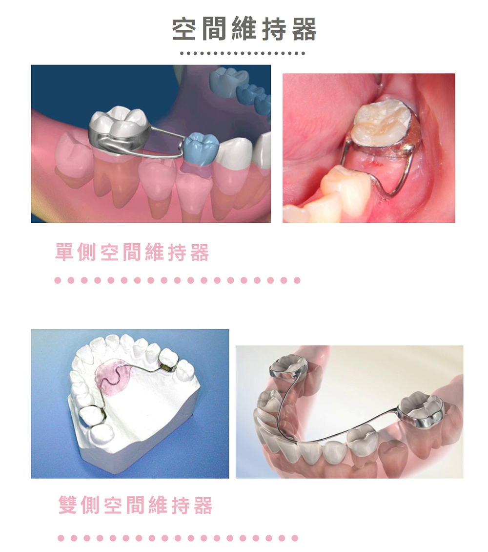 兒童牙科 兒童牙科