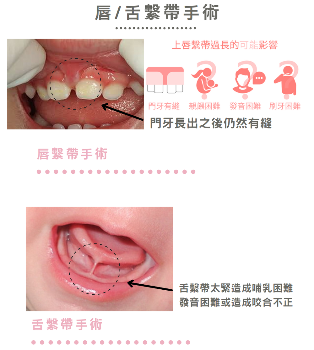 兒童牙科 兒童牙科