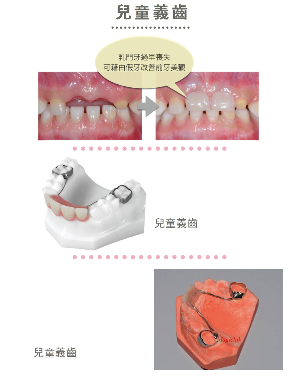兒童牙科 兒童牙科