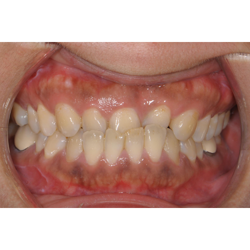 隱適美跨科合作案例