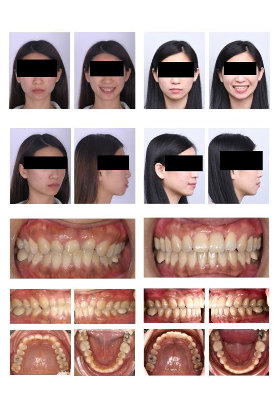 隱適美跨科合作案例