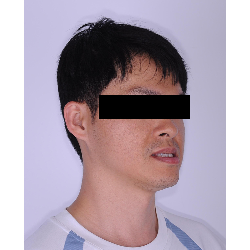 隱適美戽斗案例