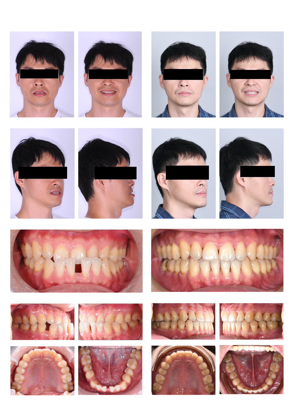 隱適美戽斗案例