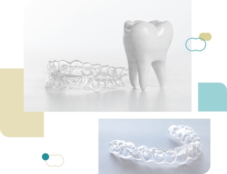 隱形矯正六大優勢